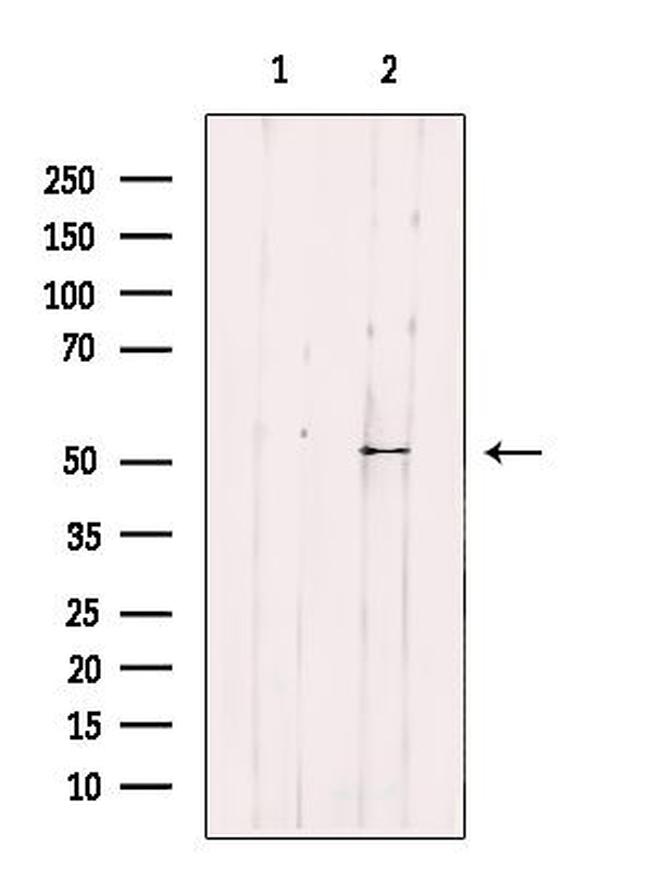 IP6K3 Antibody in Western Blot (WB)