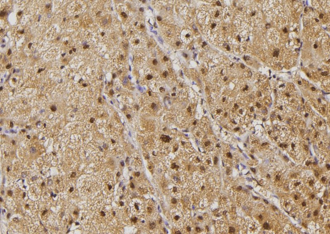 ILKAP Antibody in Immunohistochemistry (Paraffin) (IHC (P))