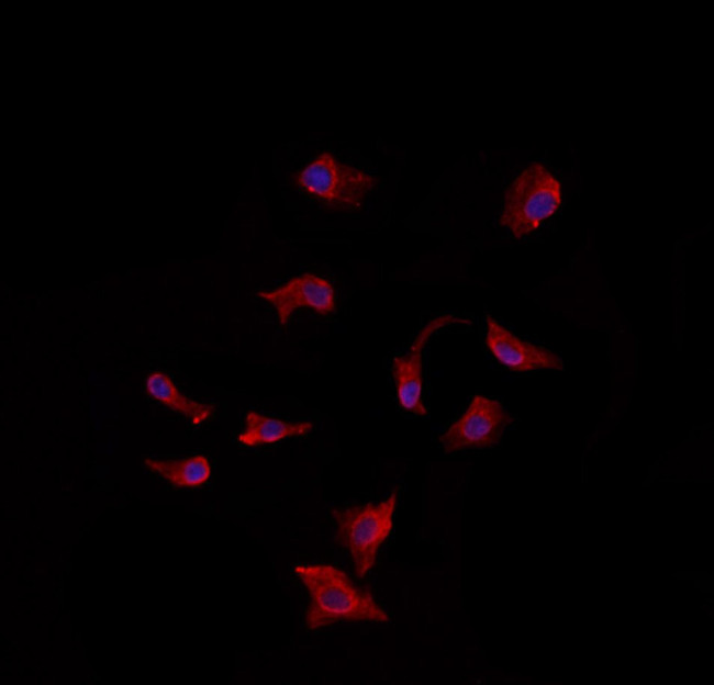 CDH18 Antibody in Immunocytochemistry (ICC/IF)