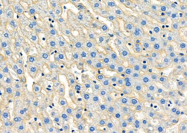 CDH18 Antibody in Immunohistochemistry (Paraffin) (IHC (P))