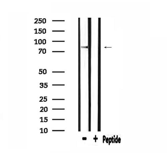 CDH18 Antibody in Western Blot (WB)