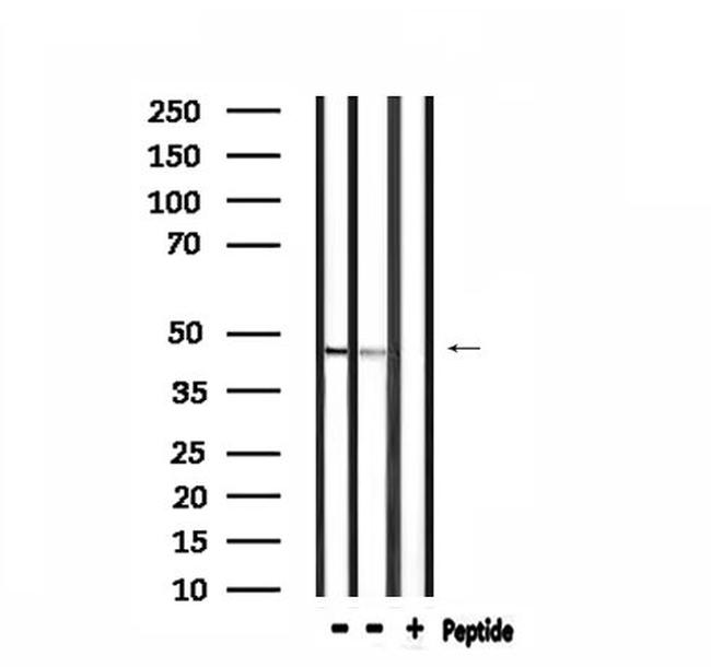 CADM2 Antibody in Western Blot (WB)