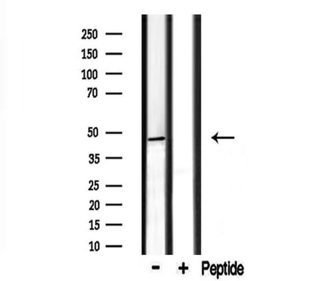 CADM2 Antibody in Western Blot (WB)