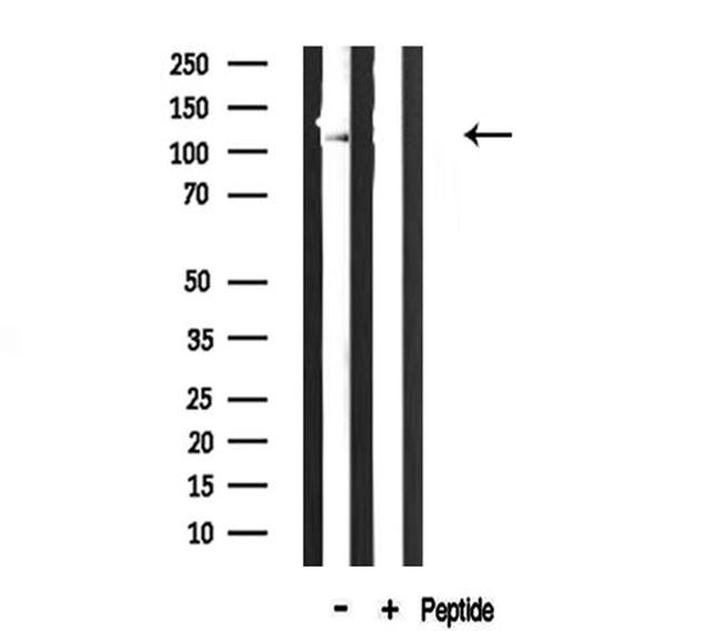 COL6A2 Antibody in Western Blot (WB)