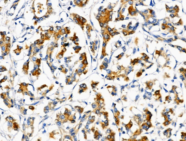 AGPAT5 Antibody in Immunohistochemistry (Paraffin) (IHC (P))