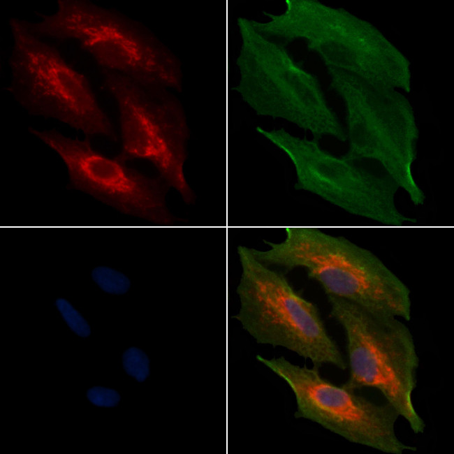 MRPL11 Antibody in Immunocytochemistry (ICC/IF)