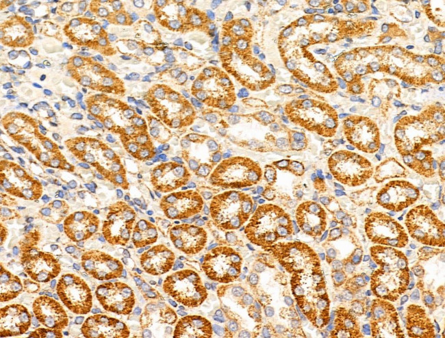 MRPL11 Antibody in Immunohistochemistry (Paraffin) (IHC (P))