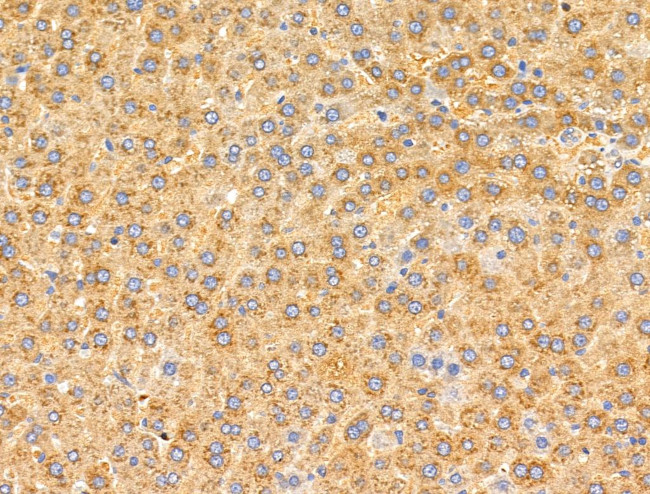 MRPL11 Antibody in Immunohistochemistry (Paraffin) (IHC (P))