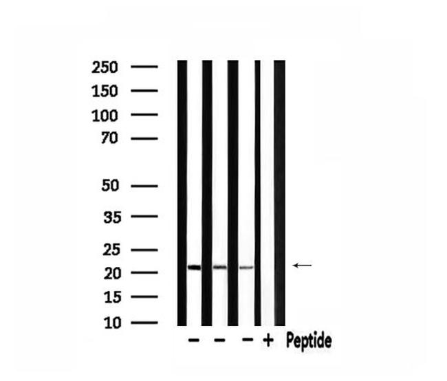 MRPL11 Antibody in Western Blot (WB)