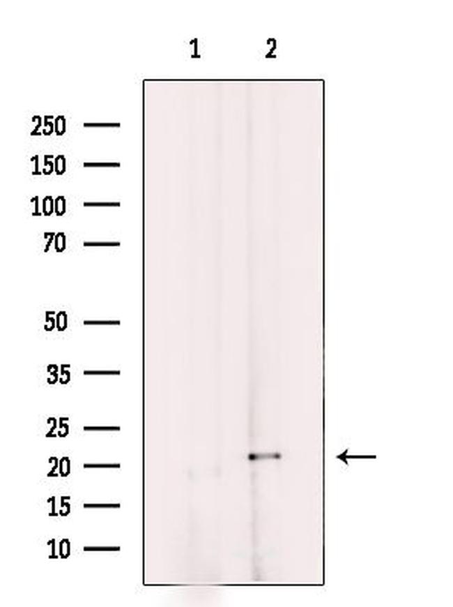 MRPL11 Antibody in Western Blot (WB)