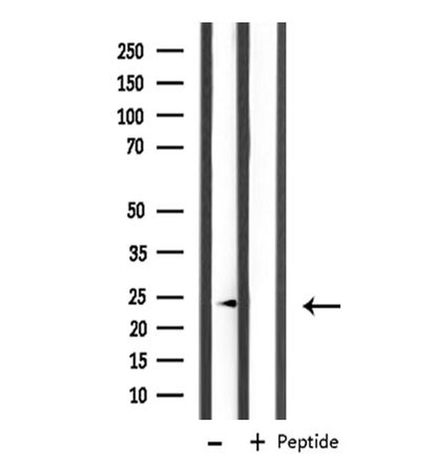 MRPL11 Antibody in Western Blot (WB)