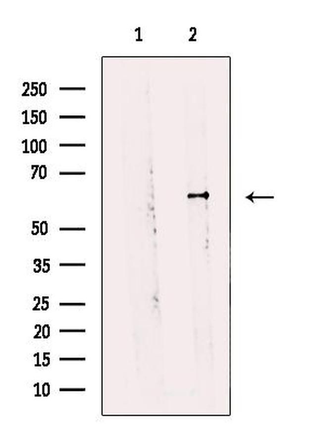 Arylsulfatase E Antibody in Western Blot (WB)