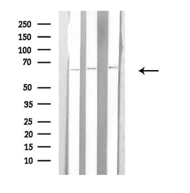 Arylsulfatase E Antibody in Western Blot (WB)