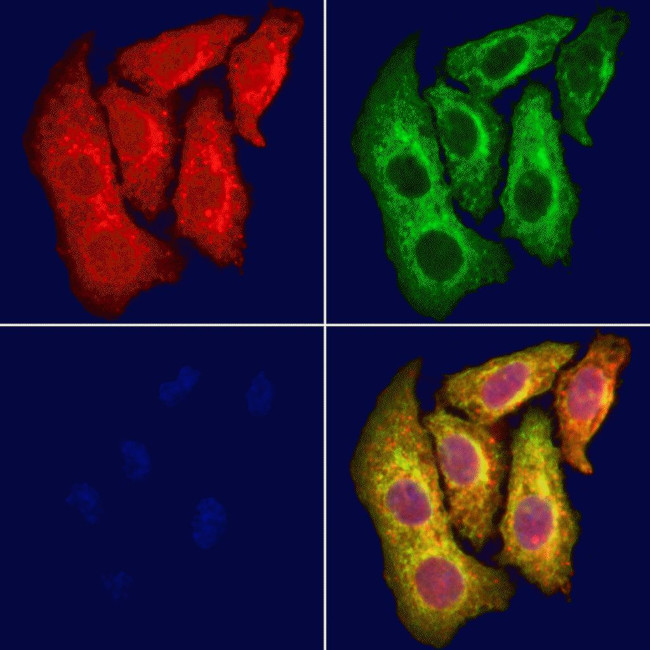 ABCA6 Antibody in Immunocytochemistry (ICC/IF)