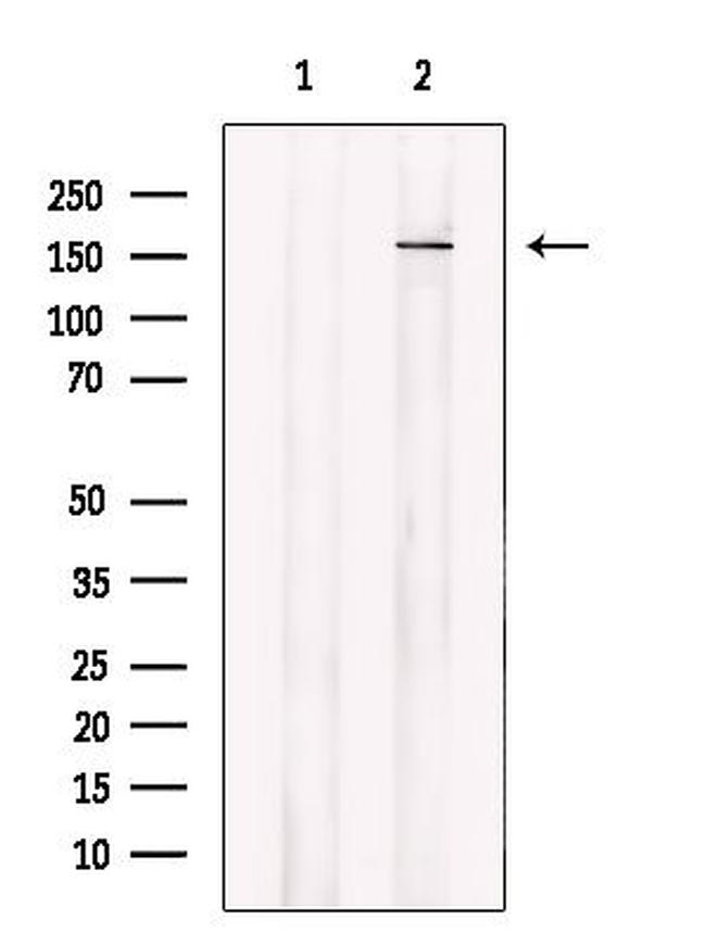 ABCA6 Antibody in Western Blot (WB)