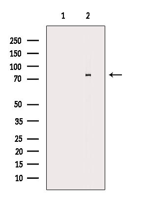 Calpain 10 Antibody in Western Blot (WB)