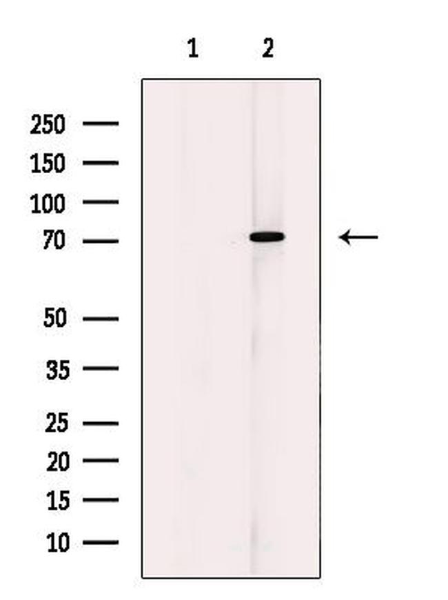 Calpain 10 Antibody in Western Blot (WB)