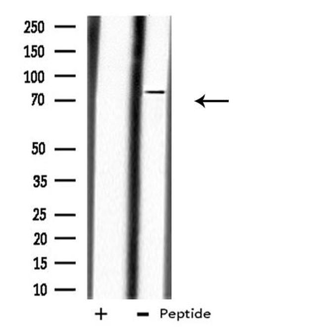 Calpain 10 Antibody in Western Blot (WB)