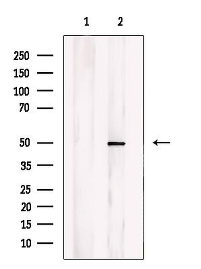 CHST1 Antibody in Western Blot (WB)
