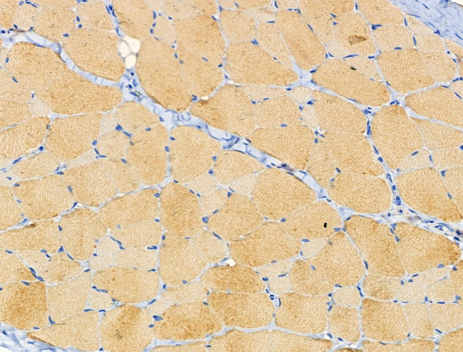 Cdc42EP4 Antibody in Immunohistochemistry (Paraffin) (IHC (P))