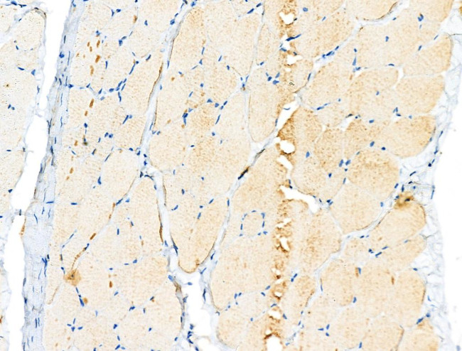 PDK1 Antibody in Immunohistochemistry (Paraffin) (IHC (P))