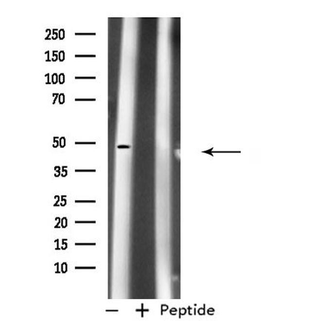 PDK1 Antibody in Western Blot (WB)