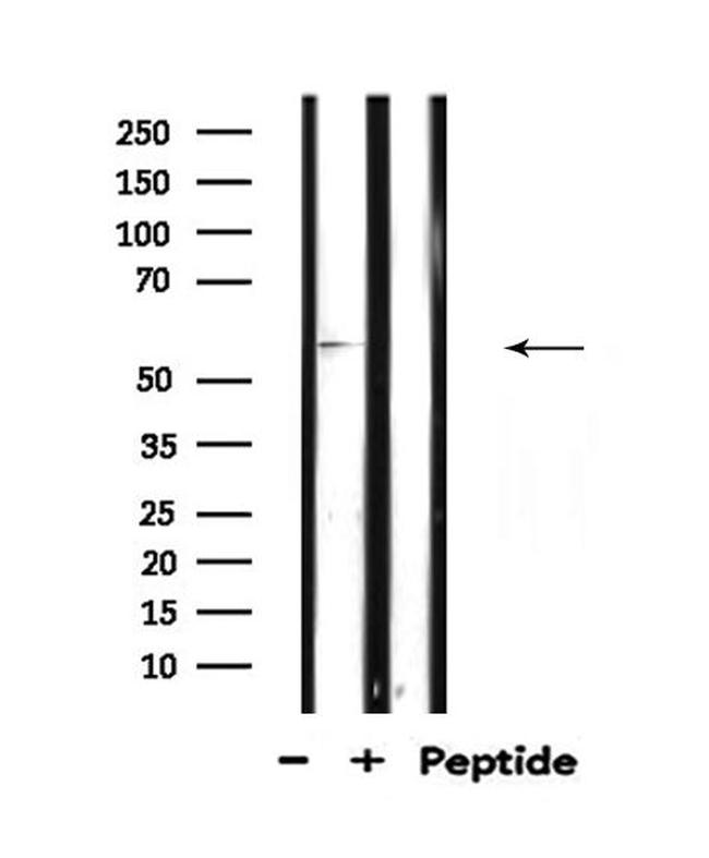 TCF4/TCF12 Antibody in Western Blot (WB)