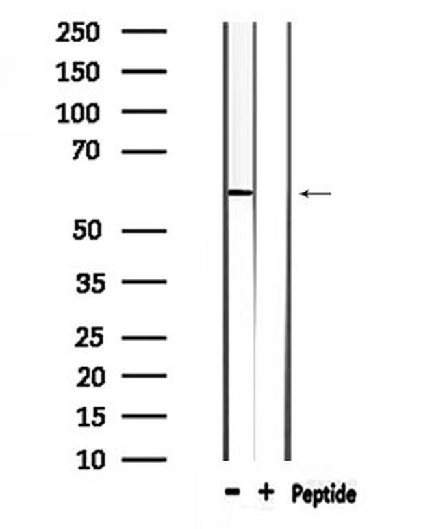 WASF3 Antibody in Western Blot (WB)