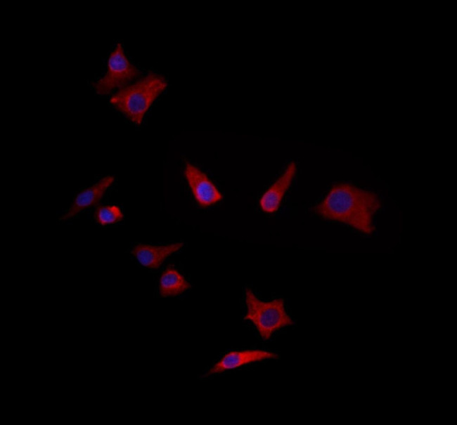 ZADH2 Antibody in Immunocytochemistry (ICC/IF)