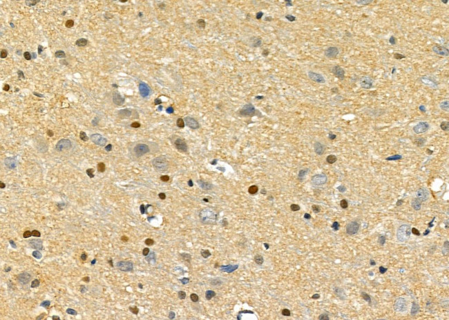 DUSP10 Antibody in Immunohistochemistry (Paraffin) (IHC (P))