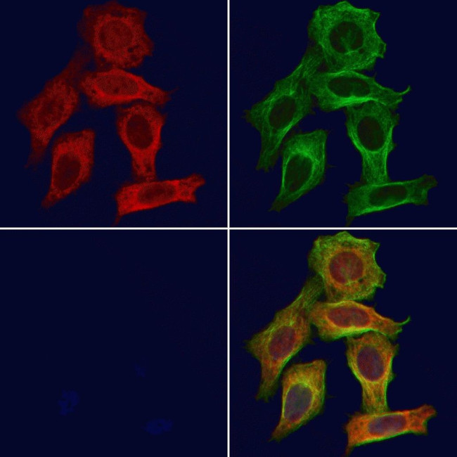 IL18BP Antibody in Immunocytochemistry (ICC/IF)