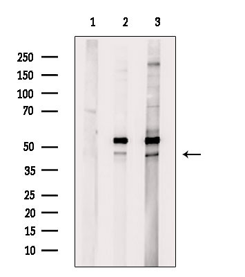 CK1 delta Antibody in Western Blot (WB)