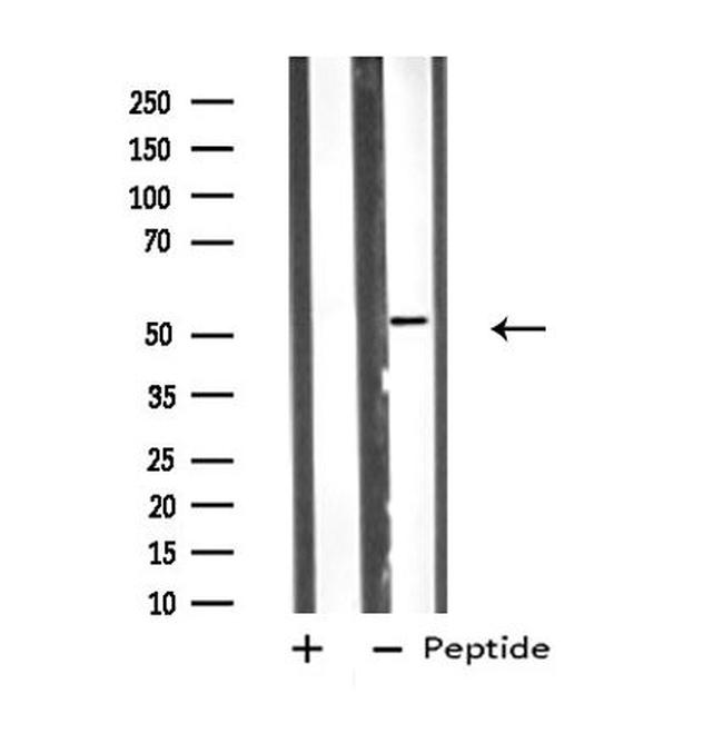 VRK3 Antibody in Western Blot (WB)