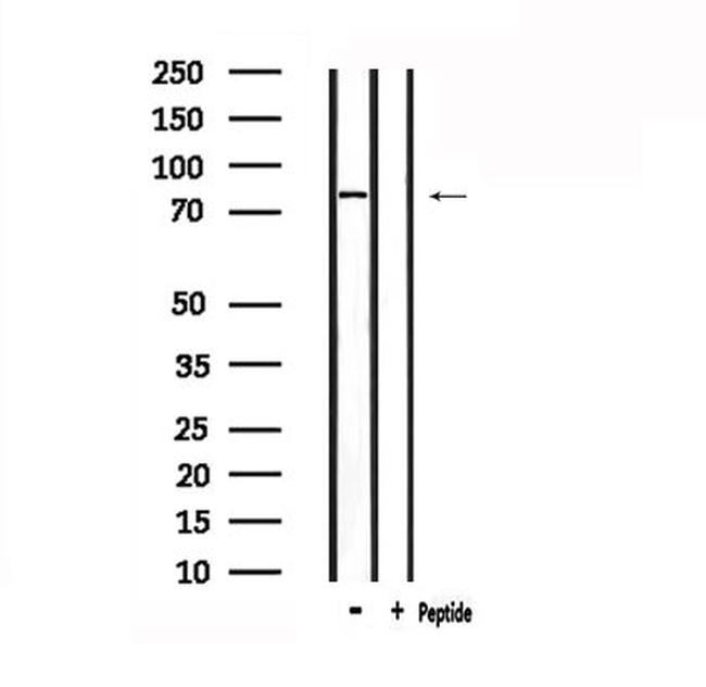 TRIF Antibody in Western Blot (WB)