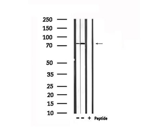 TRIF Antibody in Western Blot (WB)