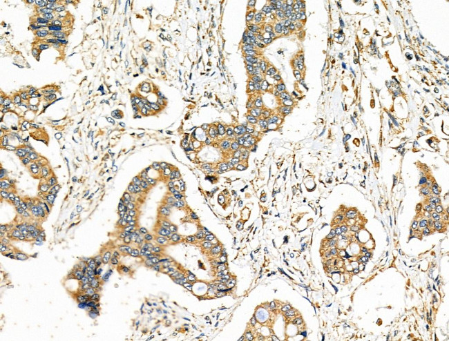 CYP1B1 Antibody in Immunohistochemistry (Paraffin) (IHC (P))