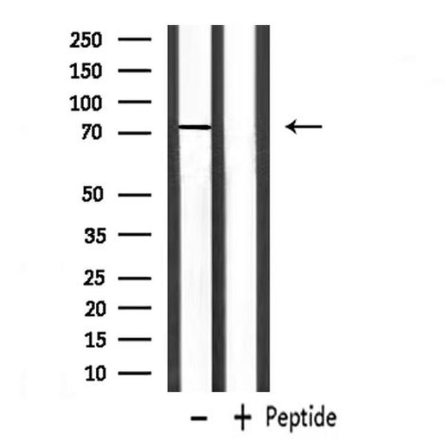 Zyxin Antibody in Western Blot (WB)