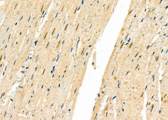 FBXO32 Antibody in Immunohistochemistry (Paraffin) (IHC (P))