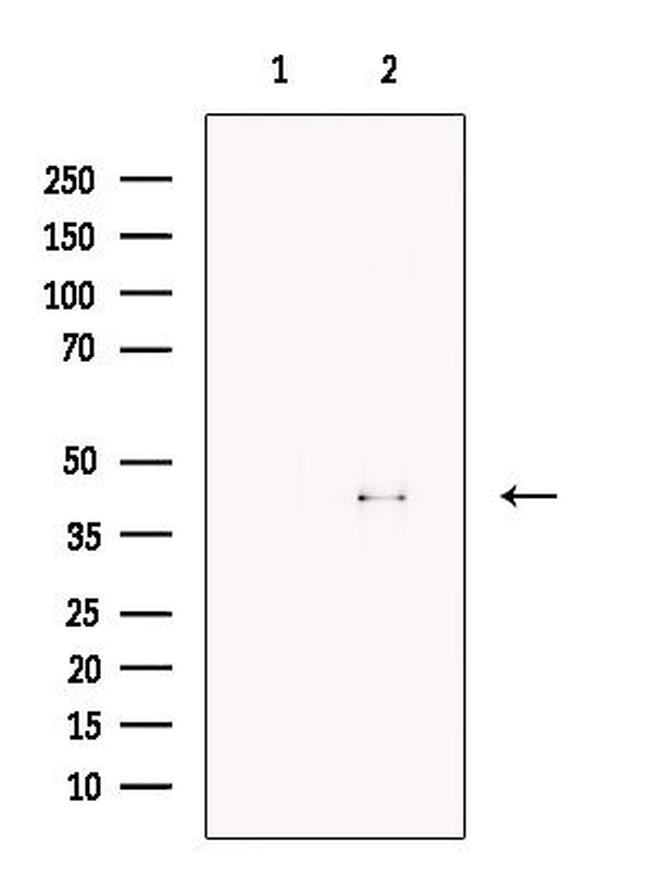 FBXO32 Antibody in Western Blot (WB)