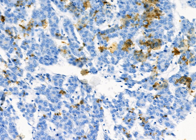 NQO2 Antibody in Immunohistochemistry (Paraffin) (IHC (P))