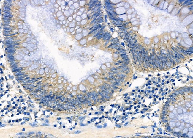 ATIC Antibody in Immunohistochemistry (Paraffin) (IHC (P))