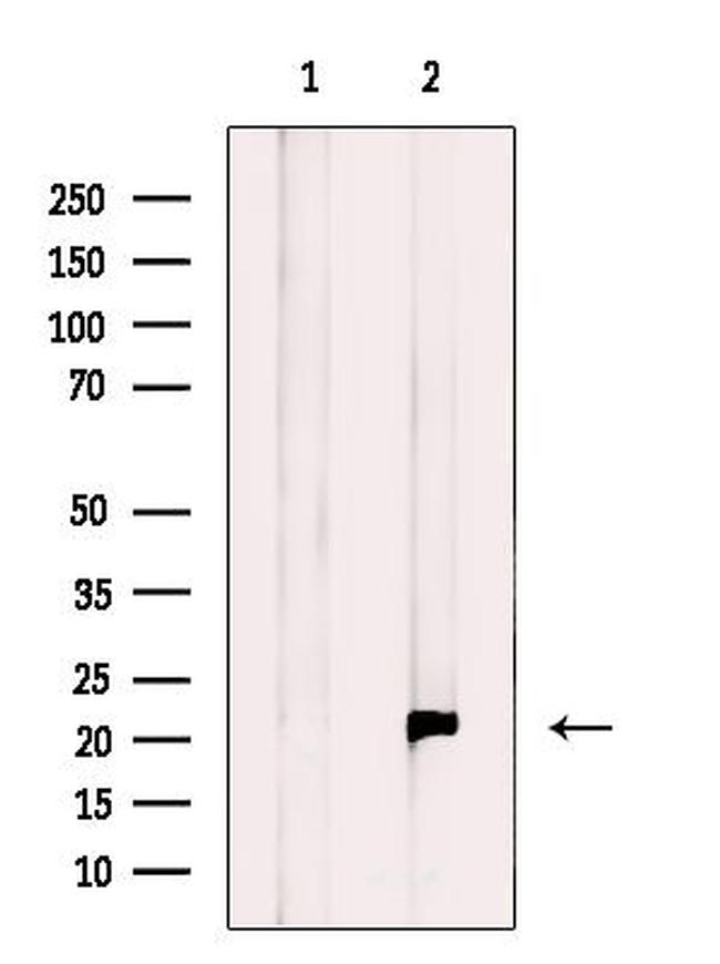 RT28 Antibody in Western Blot (WB)