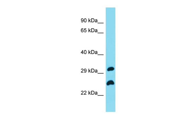 C19orf66 Antibody in Western Blot (WB)