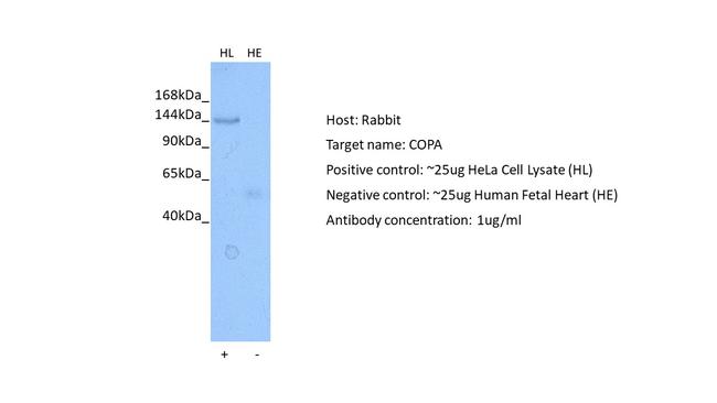 alpha COP Antibody in Western Blot (WB)