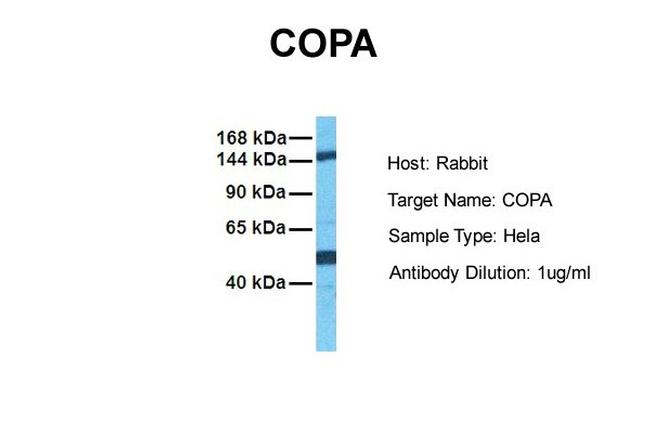 alpha COP Antibody in Western Blot (WB)