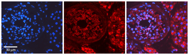 Myosin Skeletal Muscle Antibody in Immunohistochemistry (IHC)