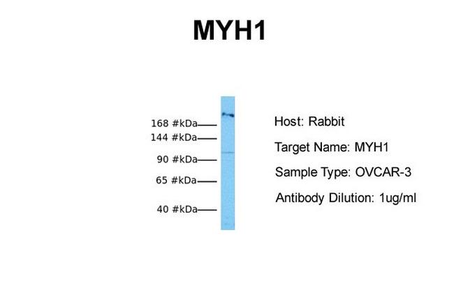 Myosin Skeletal Muscle Antibody in Western Blot (WB)