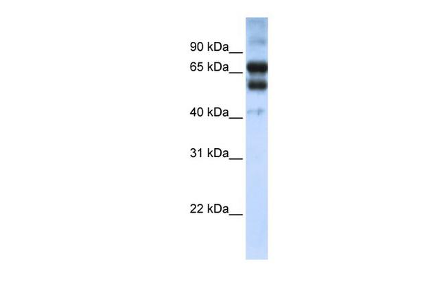 RAR gamma-2 Antibody in Western Blot (WB)