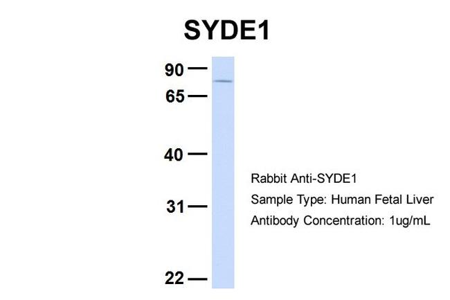 SYDE1 Antibody in Western Blot (WB)
