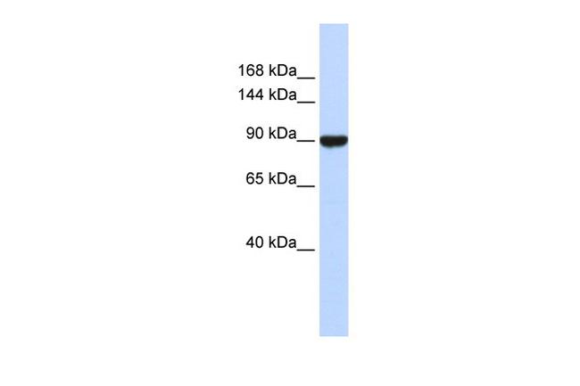 AVIL Antibody in Western Blot (WB)